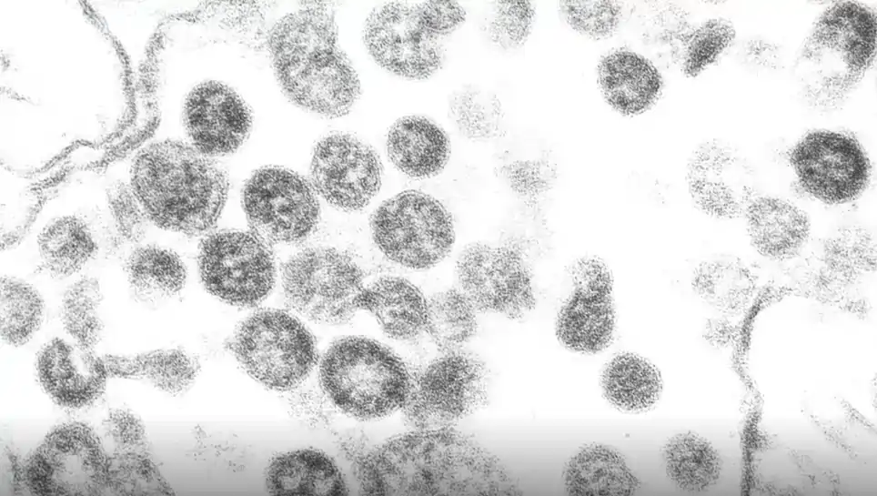 Human Metapneumovirus
