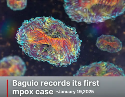 Baguio First Mpox Case